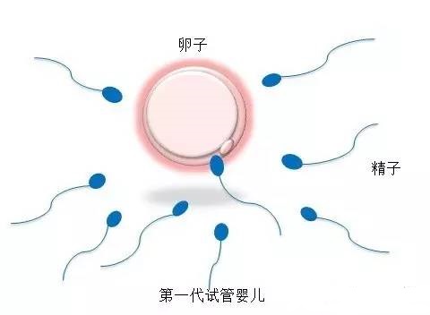 冷冻设备